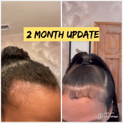 2oz Hair Growth Oil