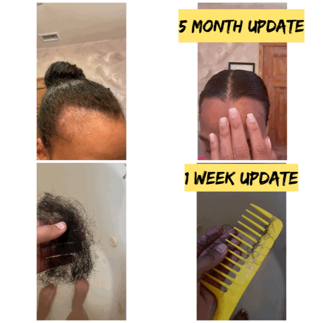 2oz Hair Growth Oil